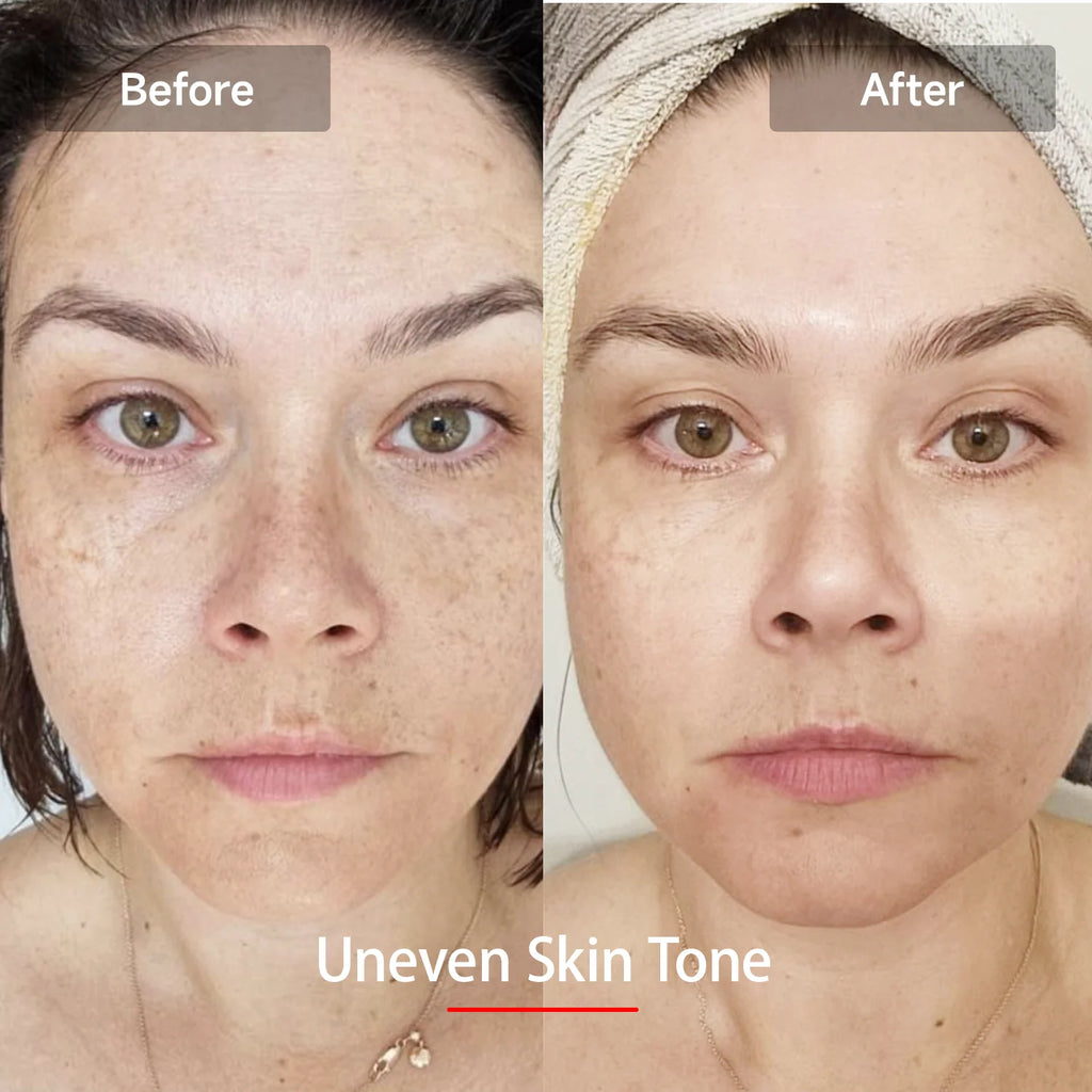 Red Light Therapy Mask for Face & Neck | 7-Color Skin Rejuvenation