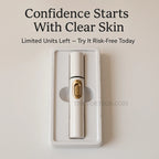 Spider Veins Removal Pen - Blue Light Therapy Laser Pen For Varicose Veins