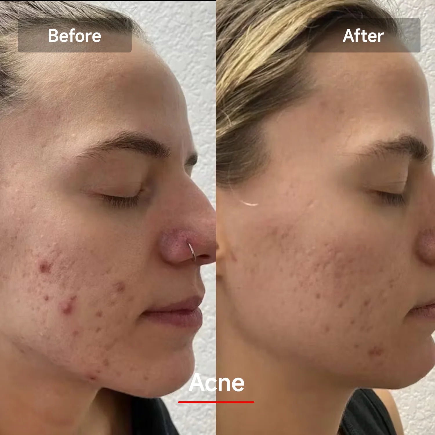 Red Light Therapy Mask for Face & Neck | 7-Color Skin Rejuvenation