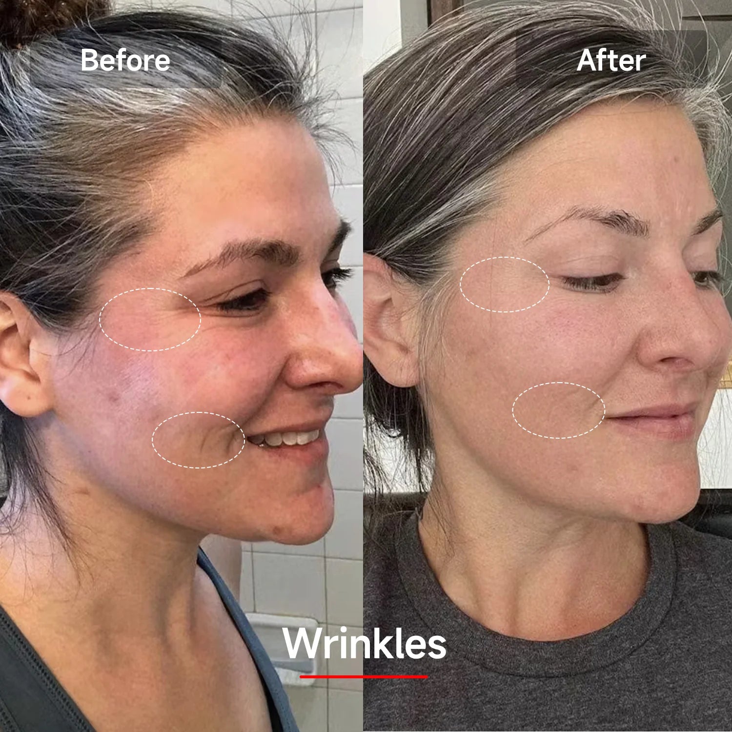Red Light Therapy Mask for Face & Neck | 7-Color Skin Rejuvenation