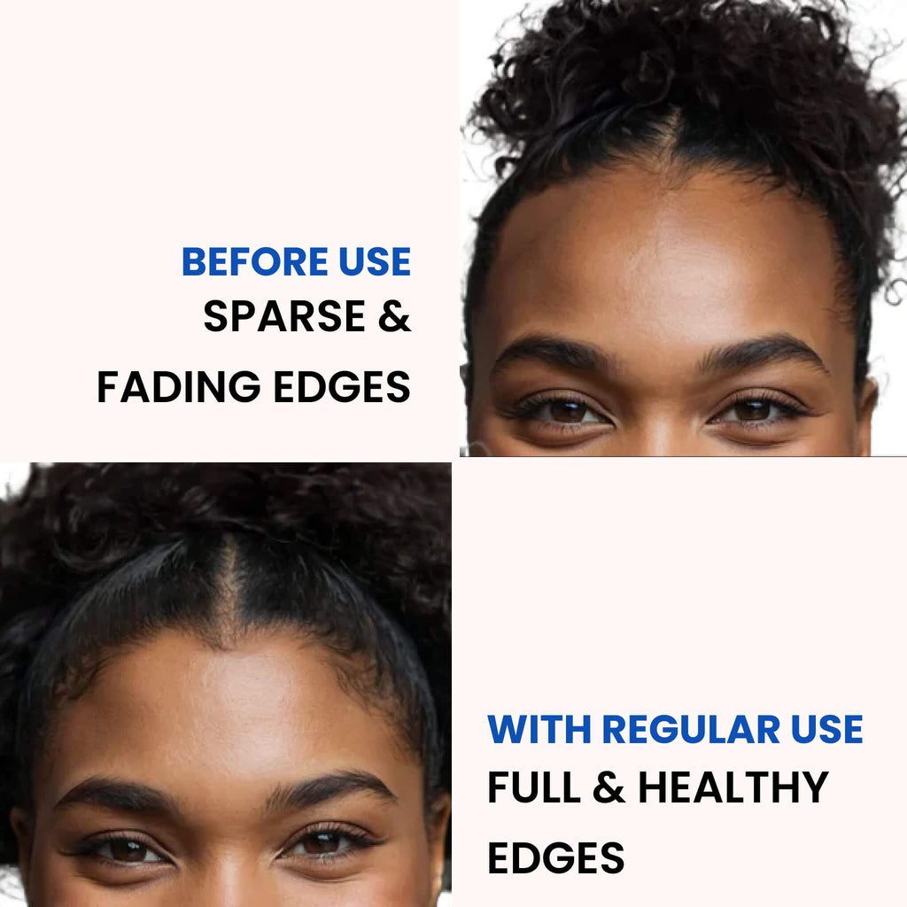 100% Pure Batana Oil | Deeply Moisturizing, Promotes Hair Growth & Repairs for Healthy Skin and Hair