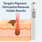 Spider Veins Removal Pen - Blue Light Therapy Laser Pen For Varicose Veins