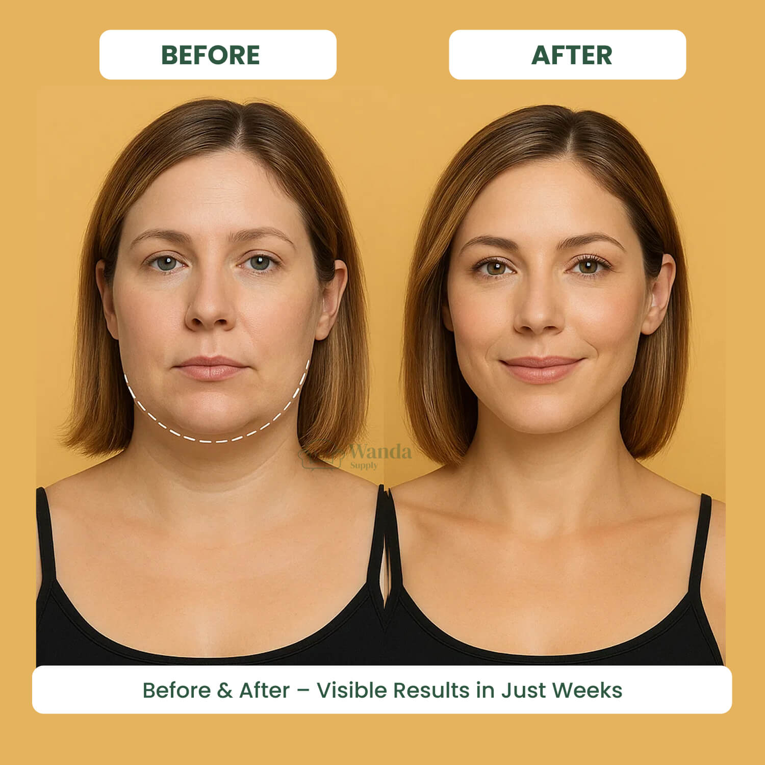 Double Chin Reducing Massager | E.M.S. & LED Light Therapy for Facial Sculpting and Contoured Jawline at Home