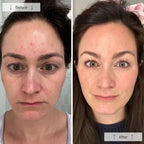 Red Light Therapy Mask for Face & Neck | 7-Color Skin Rejuvenation
