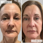 Ultra-Light 120g LED Phototherapy Mask | Deep Wrinkle Support for Aging Skin & Elderly Users