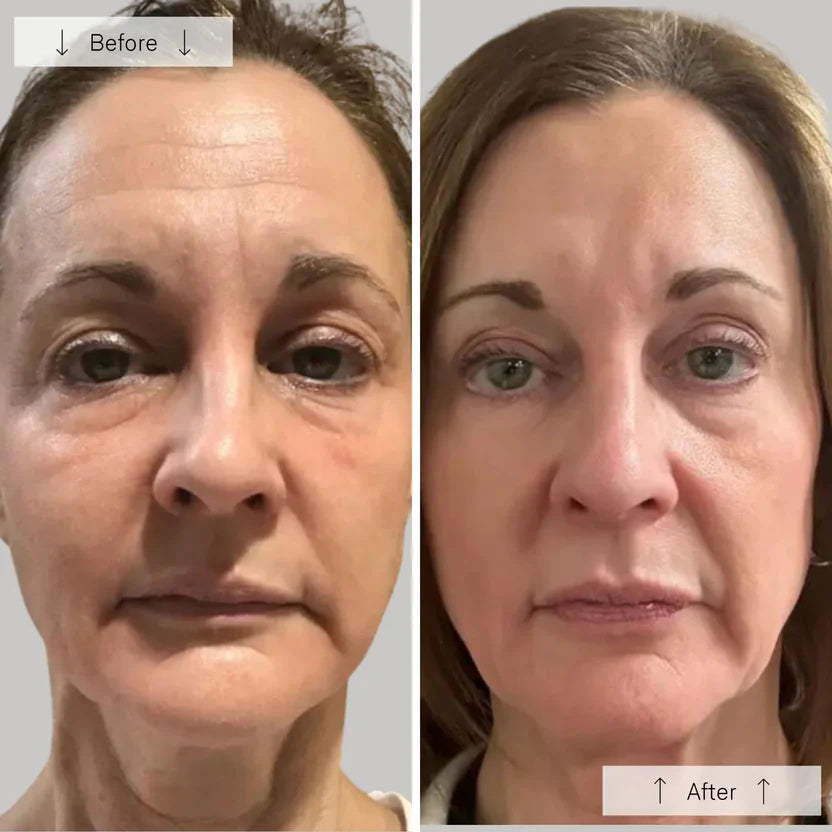 Ultra-Light 120g LED Phototherapy Mask | Deep Wrinkle Support for Aging Skin & Elderly Users