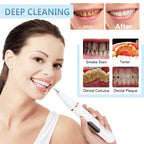 Ultrasonic Tartar Remover | 38 kHz, LED Light & USB Fast Charging for At-Home Dental Care