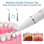 Ultrasonic Tartar Remover | 38 kHz, LED Light & USB Fast Charging for At-Home Dental Care