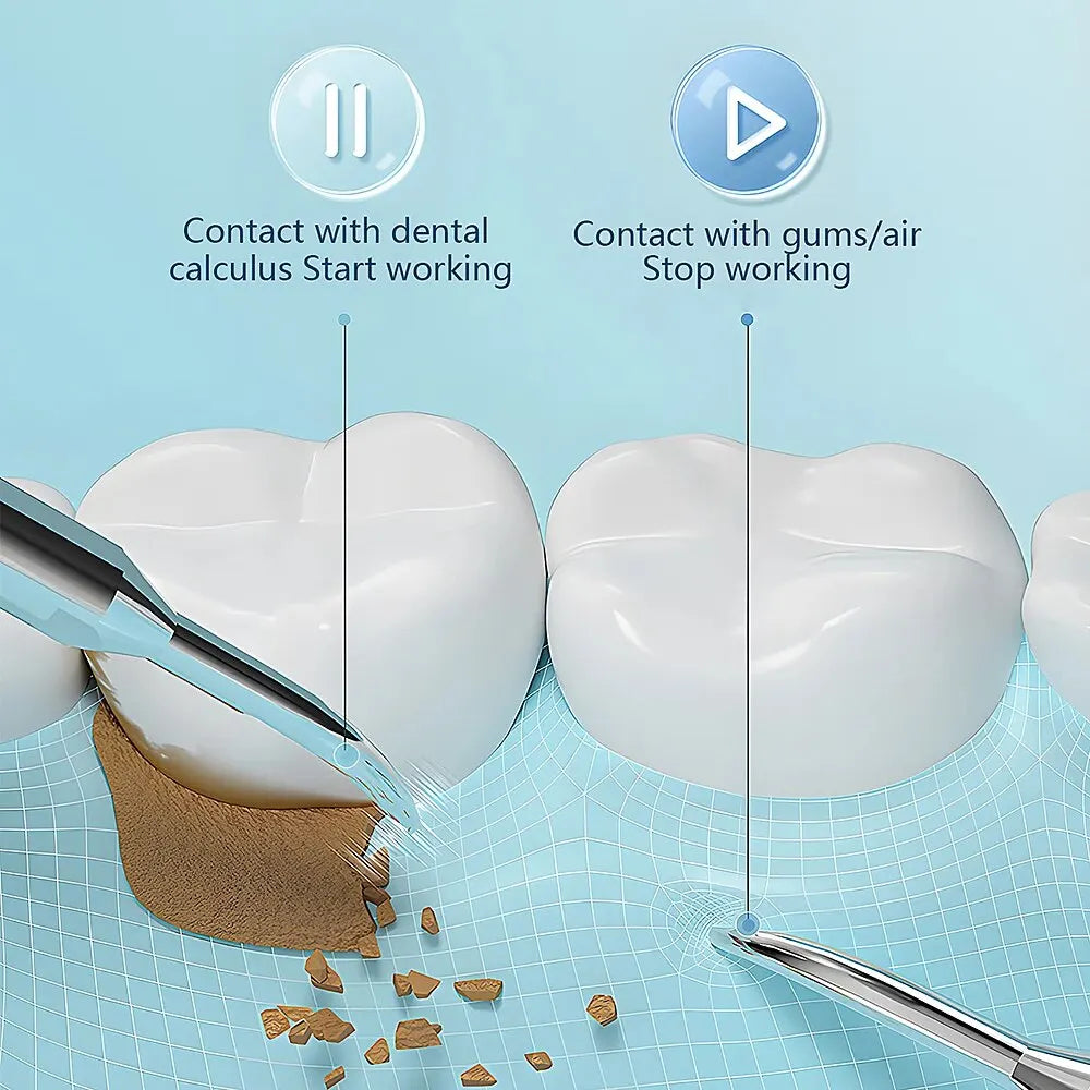 Ultrasonic Tartar Remover | 38 kHz, LED Light & USB Fast Charging for At-Home Dental Care