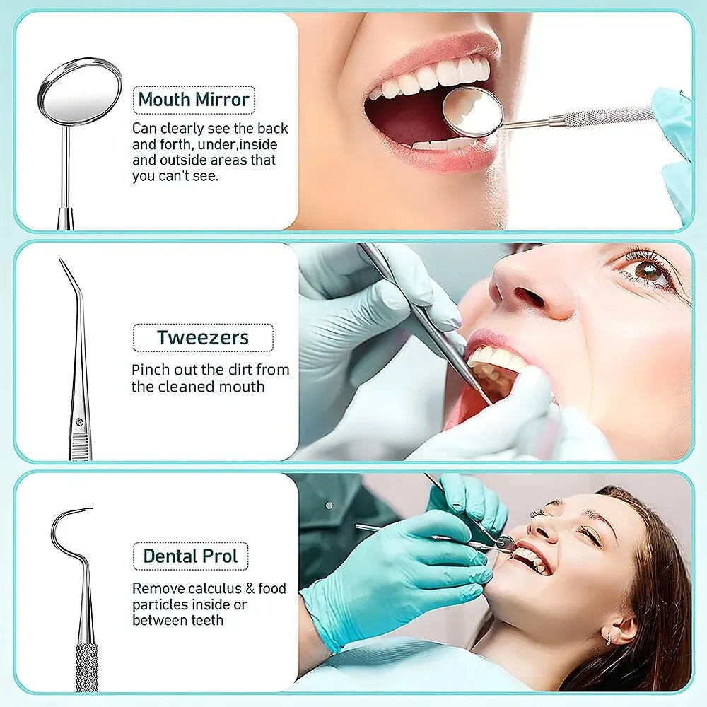 Ultrasonic Tartar Remover | 38 kHz, LED Light & USB Fast Charging for At-Home Dental Care