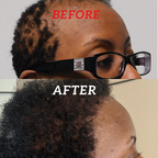 100% Pure Batana Oil | Deeply Moisturizing, Promotes Hair Growth & Repairs for Healthy Skin and Hair