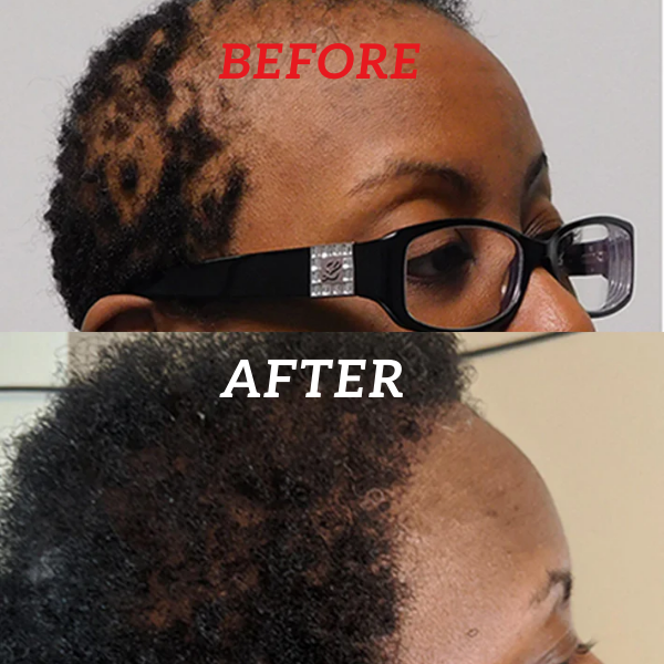100% Pure Batana Oil | Deeply Moisturizing, Promotes Hair Growth & Repairs for Healthy Skin and Hair