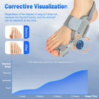 Adjustable Bunion Corrector – Toe Separator Brace | Breathable Material
