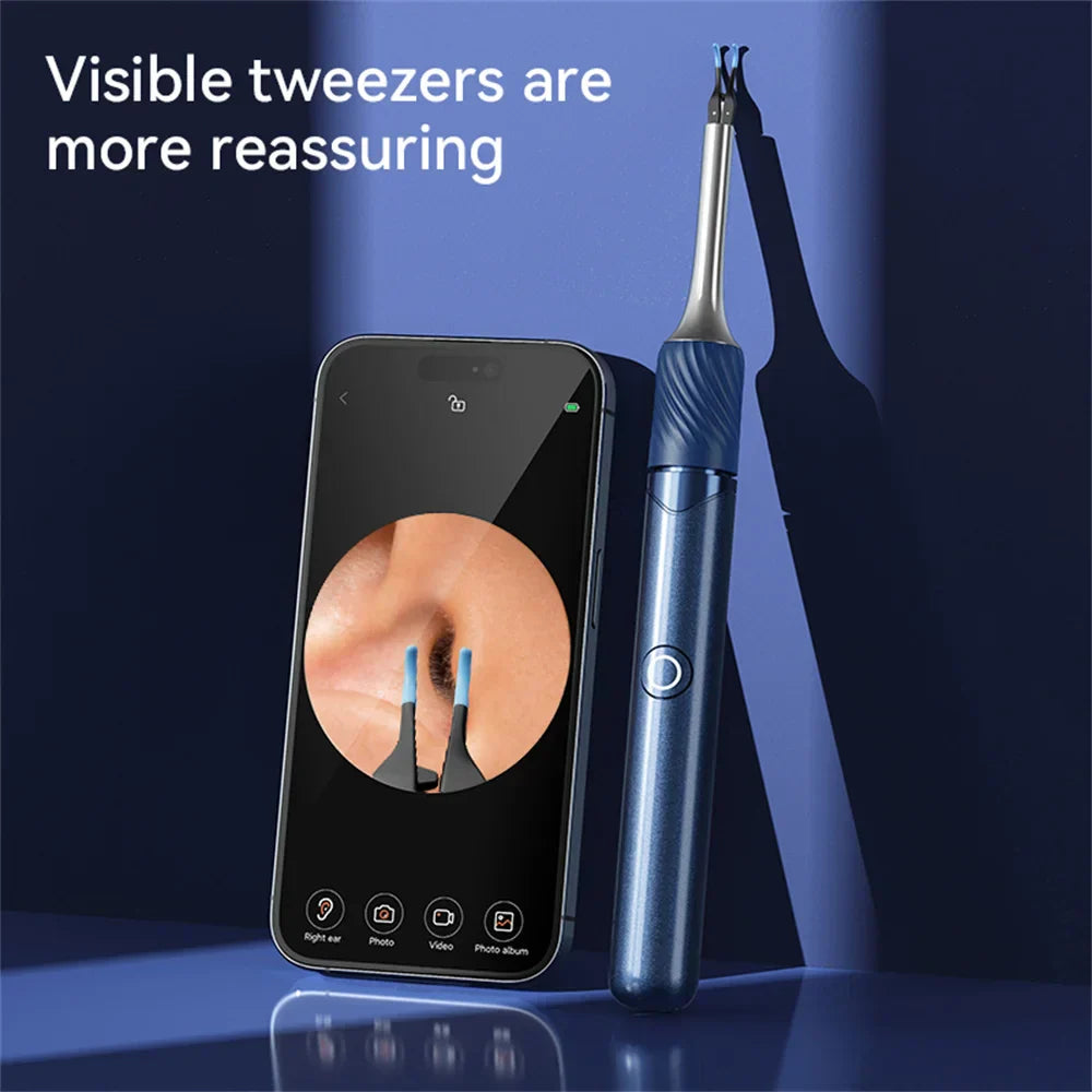 Ear Wax Removal Tool with Camera | 12MP HD Visual, Wi-Fi Connection & Safe for Adults and Kids