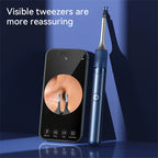 Ear Wax Removal Tool with Camera | 12MP HD Visual, Wi-Fi Connection & Safe for Adults and Kids