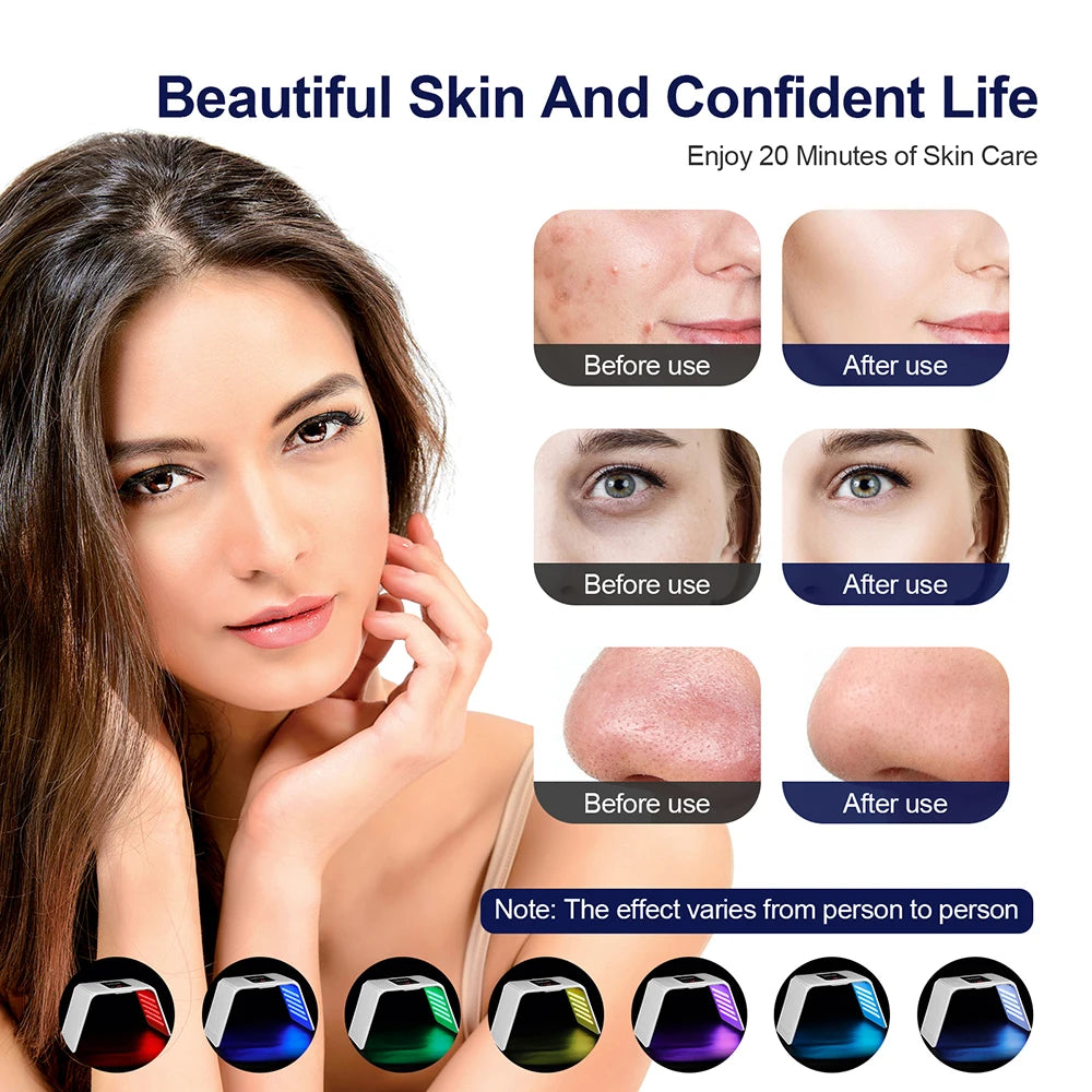 Professional LED Light Therapy Machine – 7 Modes | Foldable Design