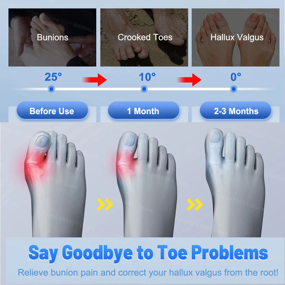 Adjustable Bunion Corrector – Toe Separator Brace | Breathable Material