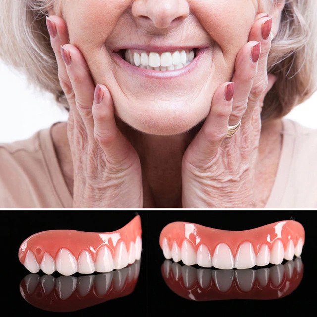 Dental Veneer Kit | Customizable, Easy Application & Ideal for At-Home Smile Makeover