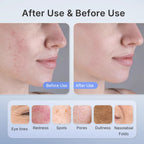 Ultra-Light 120g LED Phototherapy Mask | Deep Wrinkle Support for Aging Skin & Elderly Users