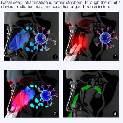 Infrared Rhinitis Therapy Device