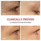 Red Light Therapy Device for Eyes | Eye Care, Pain Relief & Enhanced Vision at Home