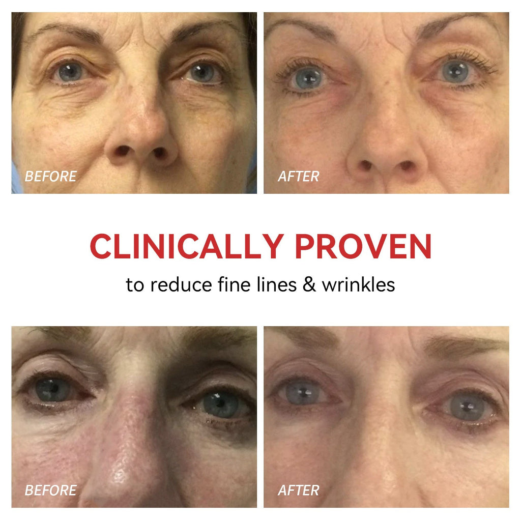 Red Light Therapy Device for Eyes | Eye Care, Pain Relief & Enhanced Vision at Home