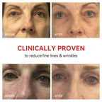 Red Light Therapy Device for Eyes | Eye Care, Pain Relief & Enhanced Vision at Home