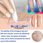 Spider Veins Removal Pen - Blue Light Therapy Laser Pen For Varicose Veins - Balma Home