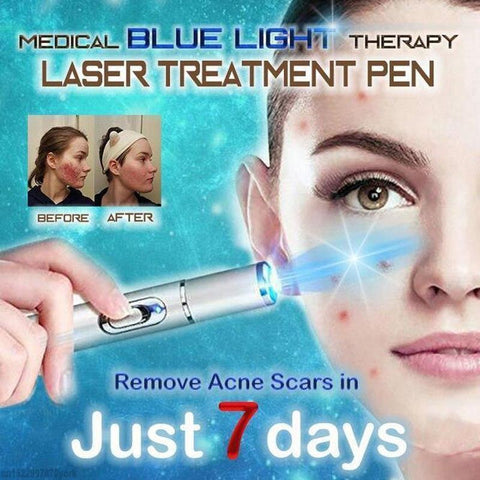 Spider Veins Removal Pen - Blue Light Therapy Laser Pen For Varicose Veins - Balma Home