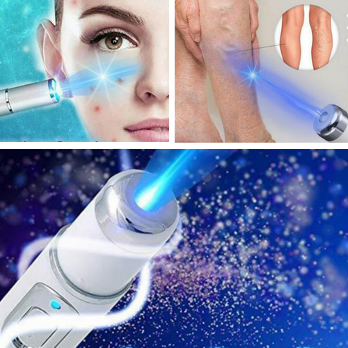 Spider Veins Removal Pen - Blue Light Therapy Laser Pen For Varicose Veins - Balma Home