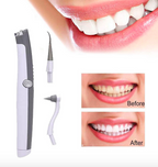 Sonic Tooth Stain Eraser With Plaque Remover - Balma Home