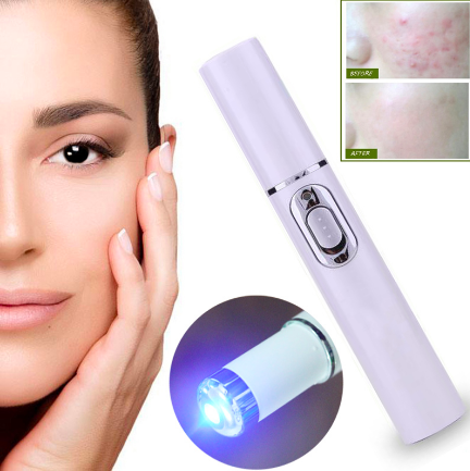 Spider Veins Removal Pen - Blue Light Therapy Laser Pen For Varicose Veins - Balma Home